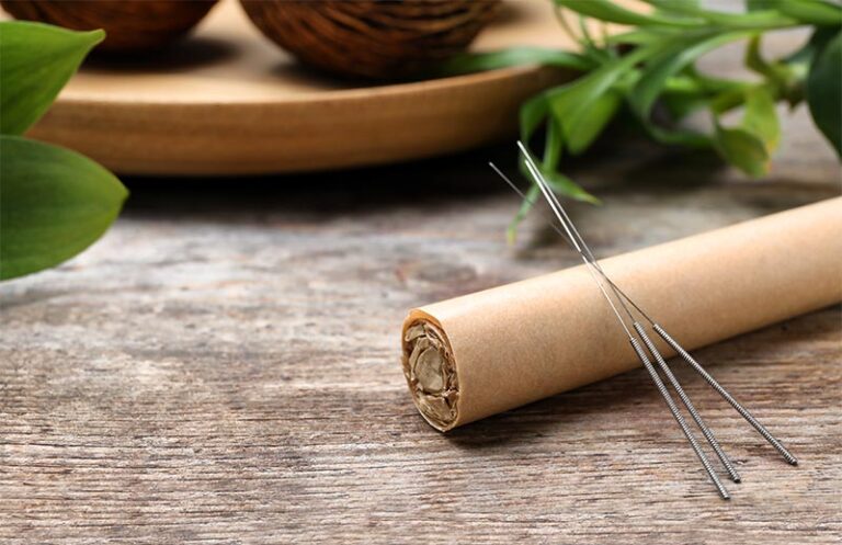 Acupuncture and moxibustion in Torquay